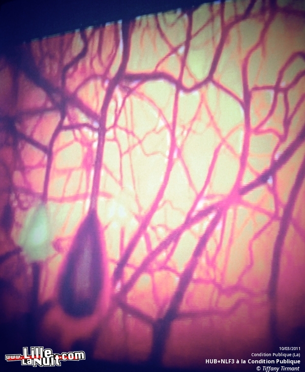 Hub + NLF3 à la Condition Publique en live - photo n°46